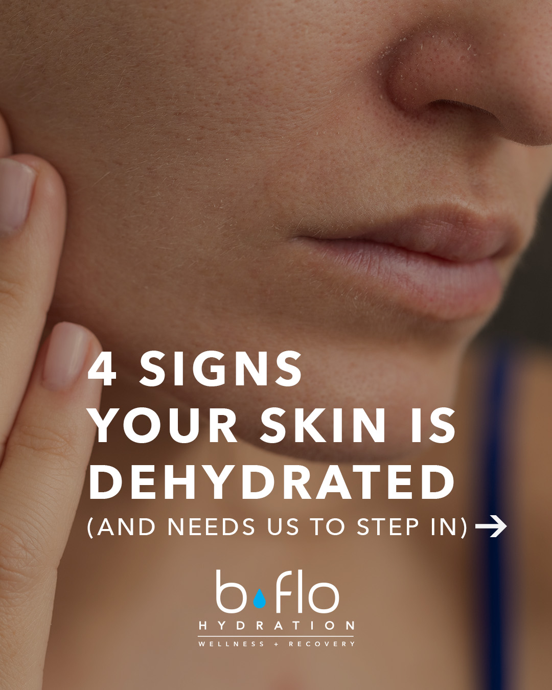 Read more about the article 4 Signs Your Skin is Dehydrated