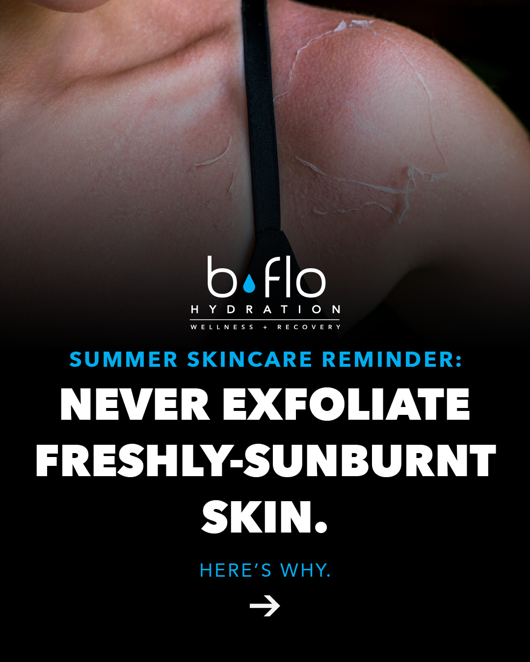 Read more about the article At BFLO Hydration Beauty, we care about your skin both in the treatment room and at home