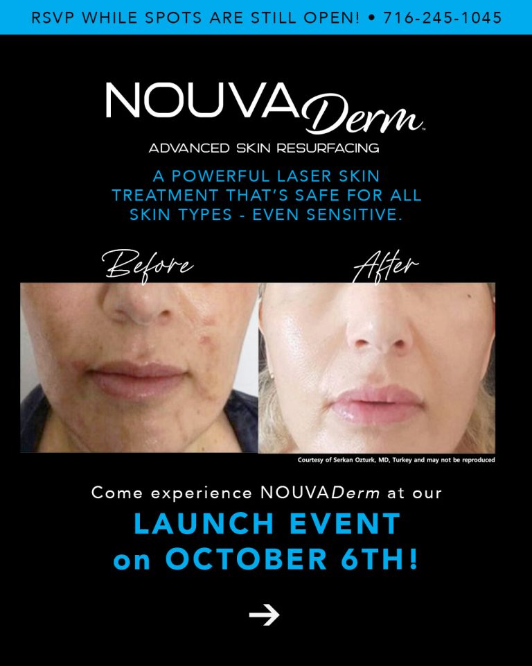 Read more about the article ✨ We’re THRILLED to be introducing NOUVADerm to BFLO Hydration. ✨